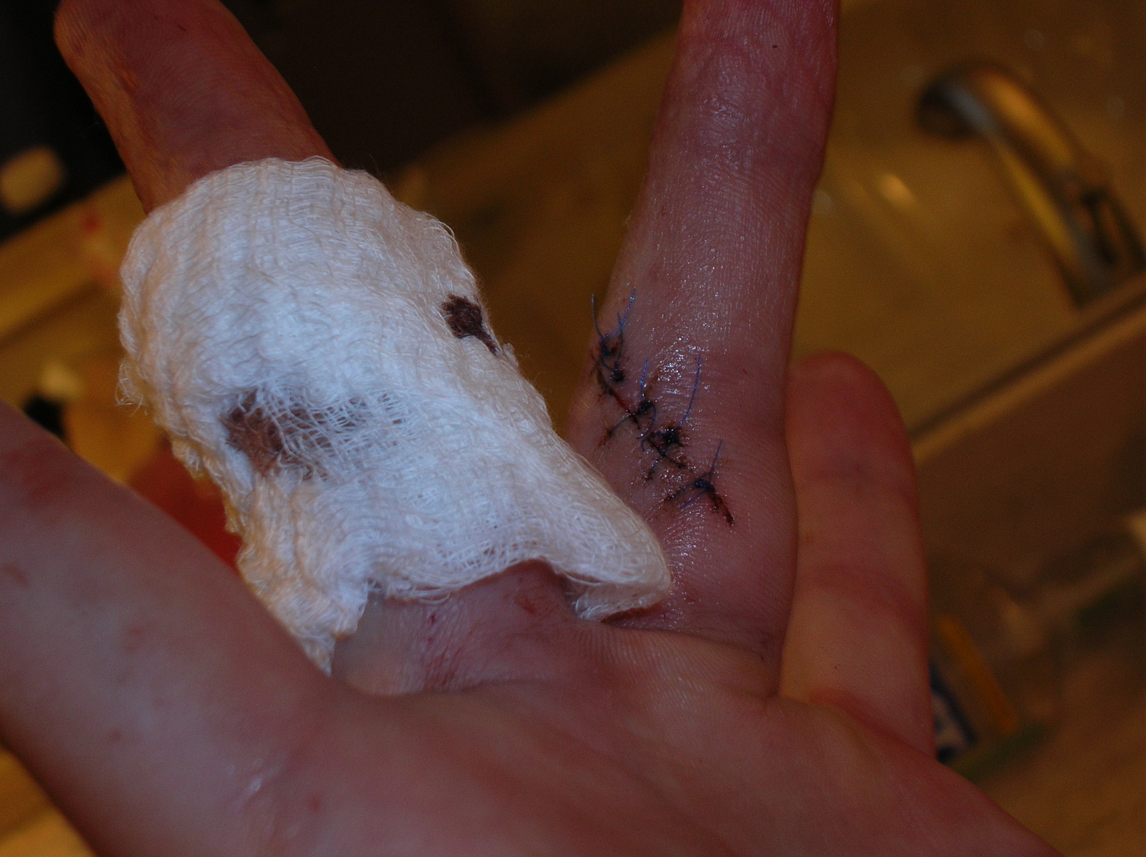 seth wound pictures 015.jpg